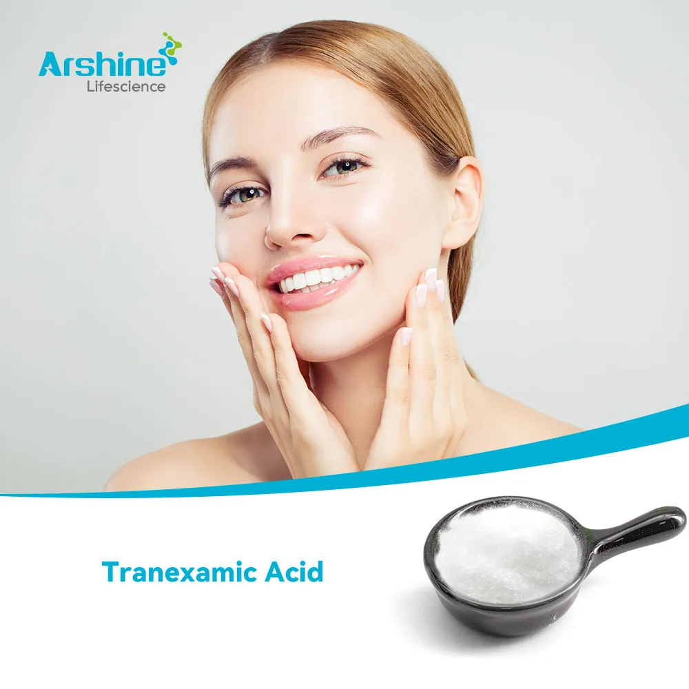 Tranexamic Acid (Trans-4-Aminomethylcyclohexanecarboxylic Acid)